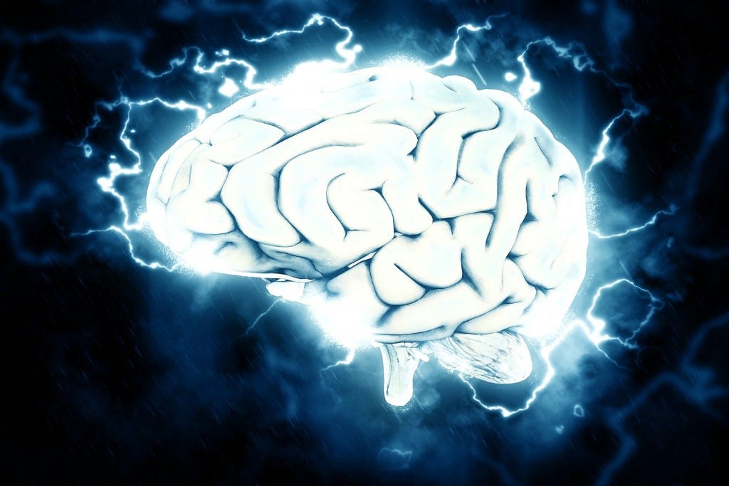 imagem de um cerebro imagem de um cerebro