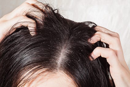 mulher a coçar a cabeça mulher a coçar a cabeça
